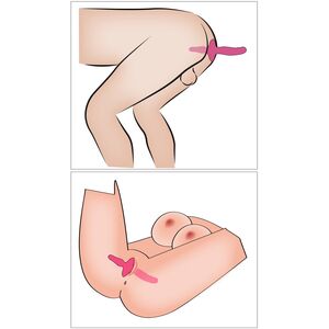 2 IN 1 VIBRATOR + BUTT PLUG – COUPLES CHOICE